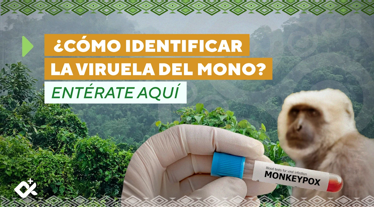 ¿Cómo identificar la Viruela del Mono?