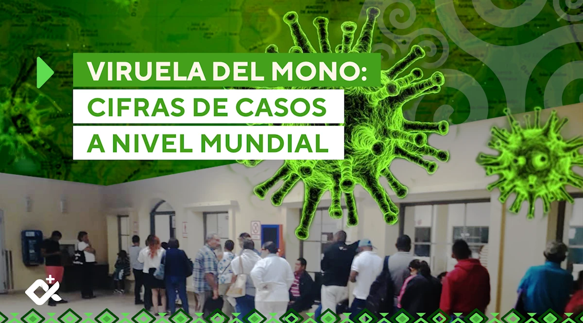 Viruela del Mono: cifras de casos a nivel mundial